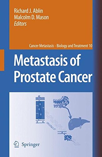 Metastasis of Prostate Cancer (Cancer Metastasis - Biology and Treatment)