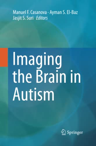 Imaging the Brain in Autism