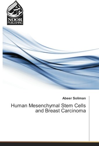 Human Mesenchymal Stem Cells and Breast Carcinoma