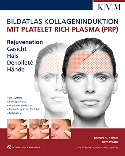 Bildatlas Kollageninduktion mit Platelet Rich Plasma (PRP): Rejuvenation Gesicht – Hals – Dekolleté – Hände