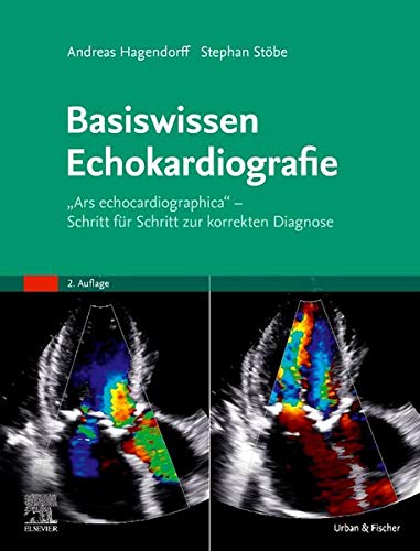 Andreas Hagendorff Basiswissen Echokardiografie, Ars Echocardiographica - Schritt Für Schritt Zur Korrekten Diagnose