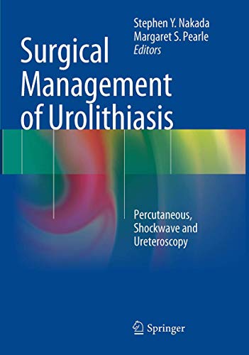 Surgical Management of Urolithiasis: Percutaneous, Shockwave and Ureteroscopy