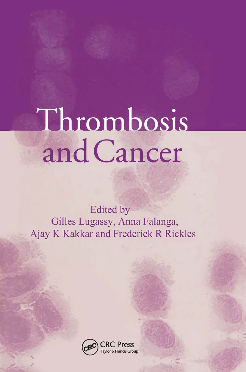 unbekannt Thrombosis And Cancer