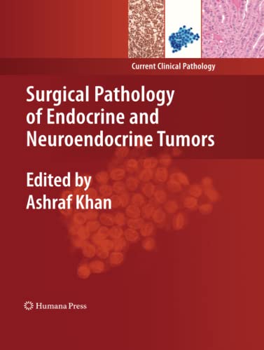 Surgical Pathology of Endocrine and Neuroendocrine Tumors (Current Clinical Pathology)
