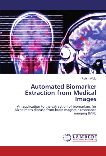 Automated Biomarker Extraction from Medical Images: An application to the extraction of biomarkers for Alzheimer's disease from brain magnetic resonance imaging (MRI)