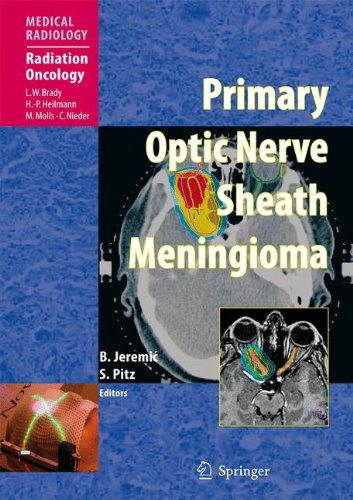 Primary Optic Nerve Sheath Meningioma (Medical Radiology)