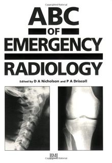 ABC of Emergency Radiology