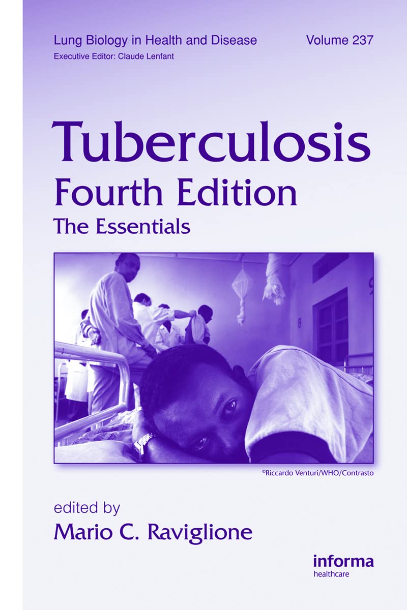 Tuberculosis: The Essentials, Fourth Edition (Lung Biology in Health and Disease, 237, Band 237)