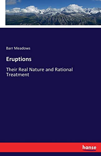 Eruptions: Their Real Nature and Rational Treatment