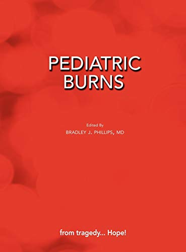 Pediatric Burns