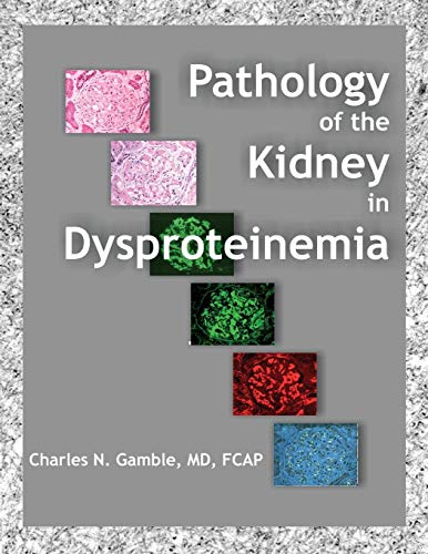 Pathology of the Kidney in Dysproteinemia