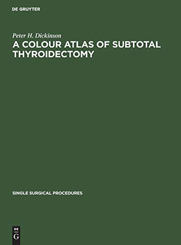 A Colour Atlas of Subtotal Thyroidectomy (Single surgical procedures, 5, Band 5)