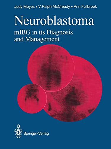 Neuroblastoma: Mibg In Its Diagnosis And Management