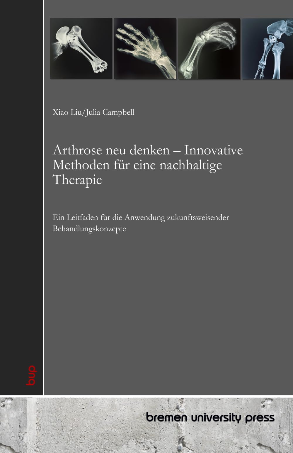 Arthrose neu denken – Innovative Methoden für eine nachhaltige Therapie: Ein Leitfaden für die Anwendung zukunftsweisender Behandlungskonzepte