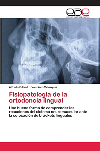 Fisiopatología de la ortodoncia lingual: Una buena forma de comprender las reacciones del sistema neuromuscular ante la colocación de brackets linguales