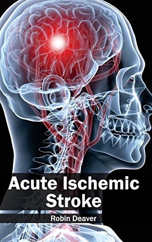 Acute Ischemic Stroke