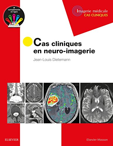 Cas Cliniques En Neuro-imagerie