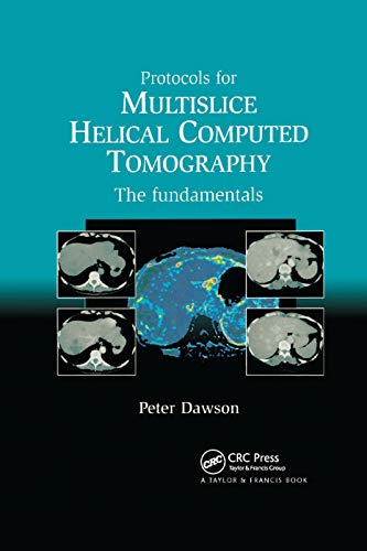 Peter Dawson Protocols For Multislice Helical Computed Tomography, The Fundamentals