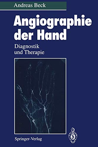 Angiographie der Hand: Diagnostik und Therapie