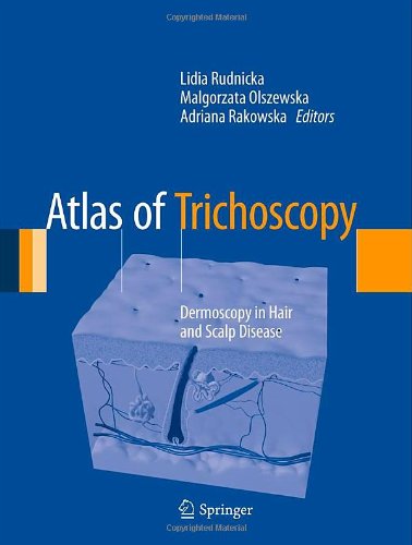 Atlas of Trichoscopy: Dermoscopy in Hair and Scalp Disease