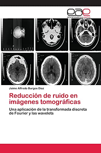 Reducción de ruido en imágenes tomográficas: Una aplicación de la transformada discreta de Fourier y las wavelets