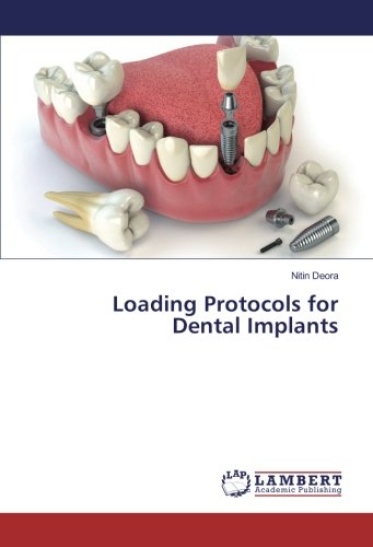 Loading Protocols for Dental Implants