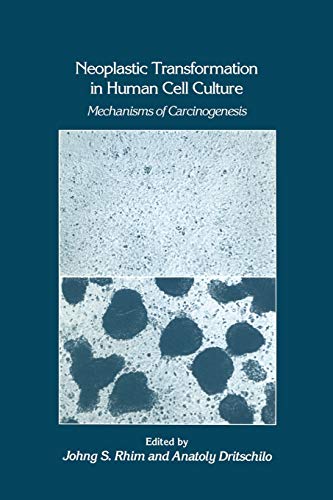 Neoplastic Transformation in Human Cell Culture: Mechanisms of Carcinogenesis (Experimental Biology and Medicine, 25, Band 25)