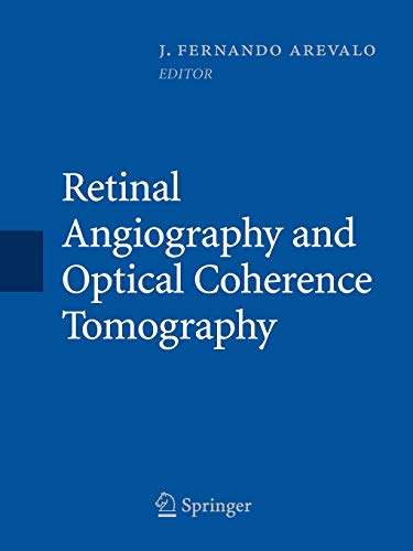 Retinal Angiography and Optical Coherence Tomography