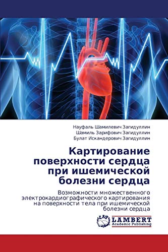 Kartirovanie poverkhnosti serdtsa pri ishemicheskoy bolezni serdtsa: Vozmozhnosti mnozhestvennogo elektrokardiograficheskogo kartirovaniya na ... tela pri ishemicheskoj bolezni serdca
