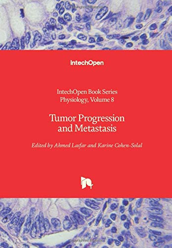 Tumor Progression and Metastasis (Physiology, 8)