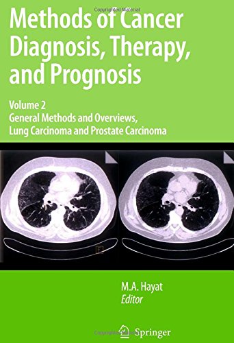 Methods of Cancer Diagnosis, Therapy and Prognosis: General Methods and Overviews, Lung Carcinoma and Prostate Carcinoma