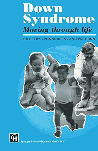 Down Syndrome: Moving Through Life
