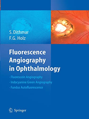 Fluorescence Angiography in Ophthalmology