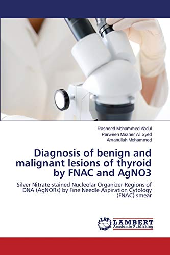 Diagnosis of benign and malignant lesions of thyroid by FNAC and AgNO3: Silver Nitrate stained Nucleolar Organizer Regions of DNA (AgNORs) by Fine Needle Aspiration Cytology (FNAC) smear