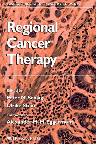 Regional Cancer Therapy (Cancer Drug Discovery and Development)