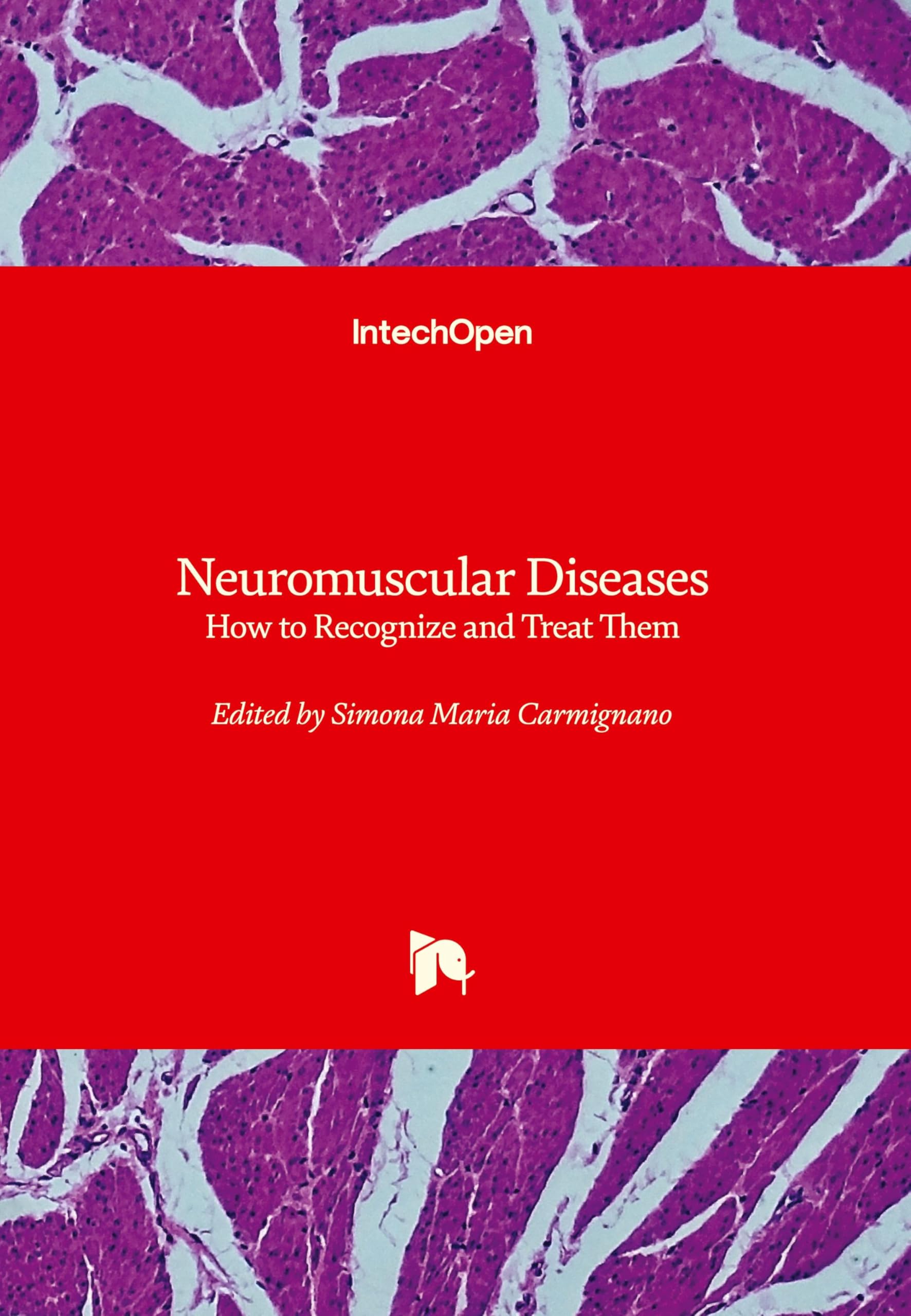 Neuromuscular Diseases - How to Recognize and Treat Them: How to Recognize and Treat Them