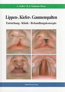 Lippen-, Kiefer-, Gaumenspalten: Entstehung - Klinik - Behandlungskonzepte