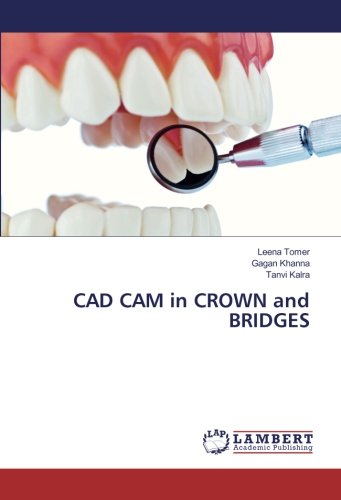 CAD CAM in CROWN and BRIDGES