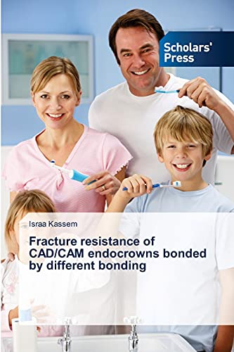 Fracture resistance of CAD/CAM endocrowns bonded by different bonding