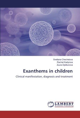 Exanthems in children: Clinical manifestation, diagnosis and treatment