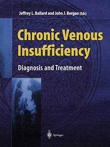 Chronic Venous Insufficiency: Diagnosis and Treatment