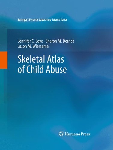 Skeletal Atlas of Child Abuse (Springer's Forensic Laboratory Science Series)