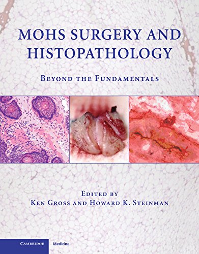 Ken Gross Md Mohs Surgery And Histopathology, Beyond The Fundamentals