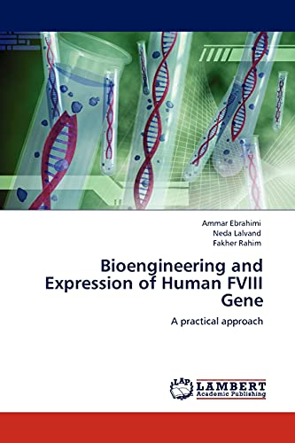 Bioengineering and Expression of Human FVIII Gene: A practical approach