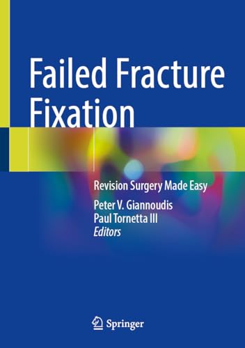 Failed Fracture Fixation: Revision Surgery Made Easy