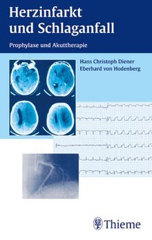 Herzinfarkt und Schlaganfall Manual