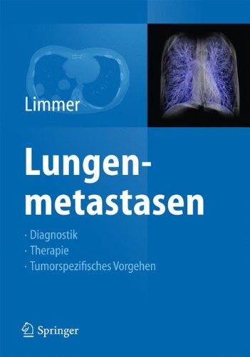 Lungenmetastasen: Diagnostik - Therapie - Tumorspezifisches Vorgehen