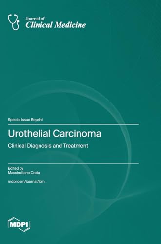 Urothelial Carcinoma: Clinical Diagnosis and Treatment