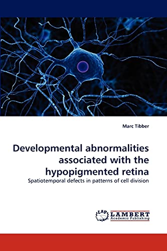 Developmental abnormalities associated with the hypopigmented retina: Spatiotemporal defects in patterns of cell division
