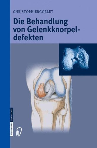 Die Behandlung von Gelenkknorpeldefekten (German Edition)